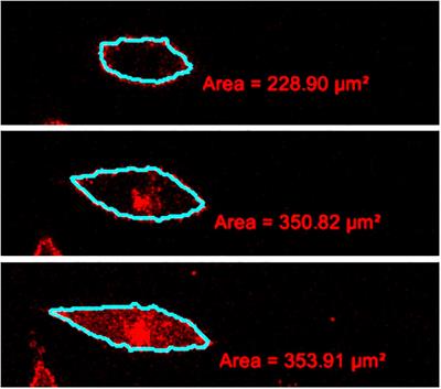 Cell Volume Changes and Membrane Ruptures Induced by Hypotonic Electrolyte and Sugar Solutions